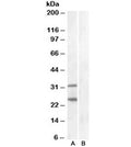 Western blot of HEK293 lysate overexpressing human SOCS1 and tested with SOCS1 antibody at 1ug/ml (mock transfection in lane B). Similar banding pattern is seen in mouse spleen. Predicted molecular weight ~24 kDa, but also may be visualized at ~37 kDa.
