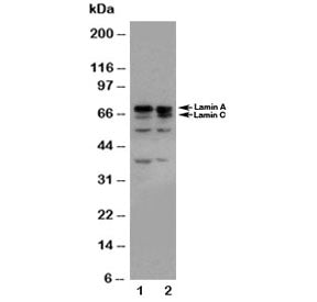 Western blot testing of Lamin A/C antibody and Lane 1: HeLa; 2: A431 cell lysate. Predicted molecular weight ~74 & 65 kDa.