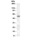 Western blot testing of human pancreas lysate with TMPRSS2 antibody at 0.1ug/ml. Predicted molecular weight: ~54 kDa.