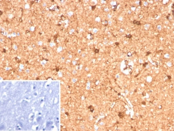 IHC staining of FFPE human brain tissue with recombinant S100B antibody (clone S100B/12587R). Inset: PBS used in place of primary Ab (secondary Ab negative control). HIER: boil tissue sections in pH 9 10mM Tris with 1mM EDTA for 20 min and allow to cool before testing.