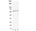 Western blot testing of VGF antibody and Lane 1: human U87; 2: (h) SHG-44; 3: mouse Neuro-2a cell lysate. Expected molecular weight: ~90/70kDa (unprocessed/processed).