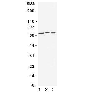 Western blot testing of VGF antibody and Lane 1: human U87; 2: (h) SHG-44; 3: mouse Neuro-2a cell lysate. Expected molecular weight: ~90/70kDa (unprocessed/processed).