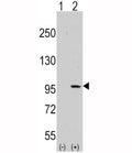 Western blot analysis of DDR1 antibody and 293 cell lysate (2 ug/lane) either nontransfected (Lane 1) or transiently transfected with the DDR1 gene (2). Predicted molecular weight: 100~125KD.