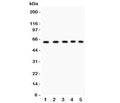 Western blot testing of LKB1 antibody and human samples 1: 293T; 2: HT1080; 3: SHG-44; 4: Jurkat; 5: placenta; Predicted molecular weight: 50~60 kDa