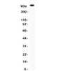 Western blot testing of von Willebrand Factor antibody and mouse lung tissue. Predicted molecular weight ~309 kDa.