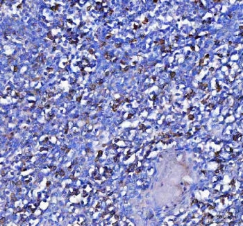 IHC staining of FFPE human tonsil tissue with MZB1 antibody. HIER: boil tissue sections in pH8 EDTA for 20 min and allow to cool before testing.