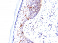 IHC testing of human skin stained with CD1a antibody (clone C1A/711).