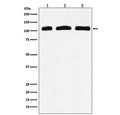 Western blot testing of 1) human K562, 2) mouse RAW264 and 3) rat kidney lysate with PIK3CD antibody. Expected molecular weight: 110-120 kDa.