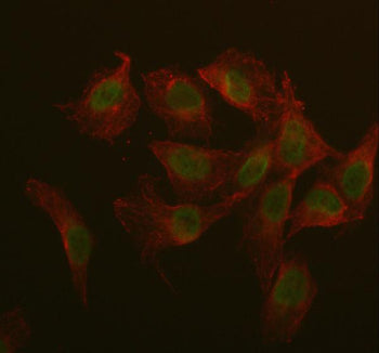 Immunofluorescent staining of IQCE using anti-IQCE antibody (green) and anti-Beta Tubulin antibody (red). IQCE was detected in immunocytochemical section of U2OS cell. Enzyme antigen retrieval was performed using IHC enzyme antigen retrieval reagent for 15 mins. The cells were blocked with 10% goat serum. And then incubated with 5 ug/ml rabbit anti-IQCE antibody and mouse anti-Beta Tubulin antibody overnight at 4oC.