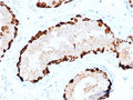 IHC testing of FFPE human testis stained with MAGEA4 antibody. Required HIER: boiling tissue sections in 10mM citrate buffer, pH6, for 10-20 min followed by cooling at RT for 20 min.