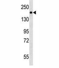 PDGFR antibody western blot analysis in mouse NIH3T3 lysate. Expected molecular weight: 123-190 kDa depending on level of glycosylation.
