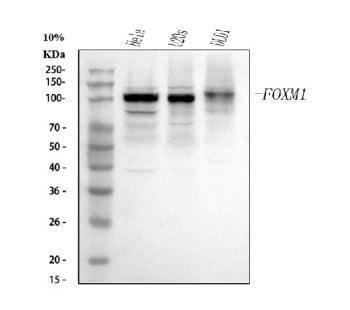 Western blot analysis of FOXM1 using anti-FOXM1 antibody. Lane 1: human Hela whole cell lysates, Lane 2: human DLD-1 whole cell lysates, Lane 3: human MCF-7 whole cell lysates, Lane 4: human U2OS whole cell lysates, Lane 5: rat thymus tissue lysates, Lane 6: rat testis tissue lysates, Lane 7: mouse thymus tissue lysates, Lane 8: mouse testis tissue lysates. After electrophoresis, proteins were transferred to a nitrocellulose membrane at 150 mA for 50-90 min.