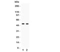 Western blot testing of E2F3 antibody and 1. HeLa, 2. COLO320 cell lysate. Expected/observed molecular weight: ~49kDa.