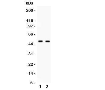 Western blot testing of E2F3 antibody and 1. HeLa, 2. COLO320 cell lysate. Expected/observed molecular weight: ~49kDa.