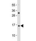 Western blot testing of human HaCaT cell lysate with TCTA antibody at 1:2000. Predicted molecular weight: 11 kDa.