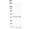 Western blot testing of Caspase-7 antibody and Lane 1: HeLa; 2: MCF-7; 3: rat liver; 4: rat kidney lysate. Expected/observed molecular weight ~34 kDa (full length).