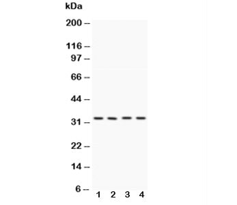 Western blot testing of Caspase-7 antibody and Lane 1: HeLa; 2: MCF-7; 3: rat liver; 4: rat kidney lysate. Expected/observed molecular weight ~34 kDa (full length).