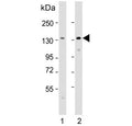 Western blot testing of human 1) A431 and 2) SH-SY5Y cell lysate with Cadherin 4 antibody. Expected molecular weight: 100-140 kDa depending on glycosylation level.