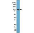Western blot testing of human HeLa cell lysate with recombinant ACTN4 antibody at 1:1000 dilution. Predicted molecular weight ~105 kDa.
