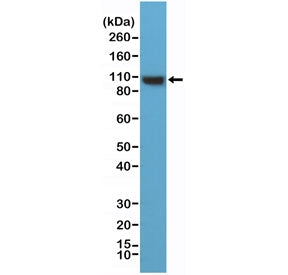 Western blot testing of human HeLa cell lysate with recombinant ACTN4 antibody at 1:1000 dilution. Predicted molecular weight ~105 kDa.