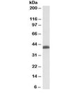 Western blot testing of K562 nuclear lysate with BMI1 antibody at 0.03ug/ml. Predicted molecular weight: 37-43 kDa.