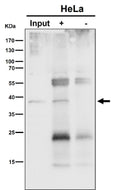 Immunoprecipitation analysis using the NSDHL antibody at 1:50 dilution. Western blot at 1:1000 dilution. NSDHL is an ER-associated membrane protein that typically migrates faster on SDS-PAGE due to signal peptide cleavage and altered SDS binding and is commonly observed at ~38 kDa.