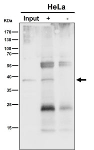 Immunoprecipitation analysis using the NSDHL antibody at 1:50 dilution. Western blot at 1:1000 dilution. NSDHL is an ER-associated membrane protein that typically migrates faster on SDS-PAGE due to signal peptide cleavage and altered SDS binding and is commonly observed at ~38 kDa.