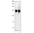 Western blot testing of human 1) HeLa and 2) MCF7 cell lysate with HER2 antibody. Predicted molecular weight ~138 kDa (unmodified), ~185 kDa (glycosylated).