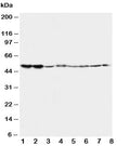 Western blot testing of 5HT2A Receptor antibody and Lane 1: rat brain; 2: rat brain; 3: mouse brain; 4: mouse brain and human samples 5: U87; 6: SMMC-7721; 7: HT1080; 8: COLO320. Predicted/observed molecular weight ~53kDa.
