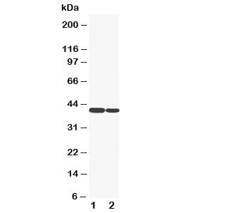 Western blot testing of Cytokeratin 19 antibody and Lane 1: HT1080; 2: COLO320 cell lysate. Predicted molecular weight ~43kDa.