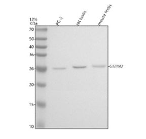 Western blot analysis of GSTM2 using anti-GSTM2 antibody. Electrophoresis was performed on a 12% SDS-PAGE gel at 80V (Stacking gel) / 120V (Resolving gel) for 2 hours. Lane 1: human PC-3 whole cell lysates, Lane 2: rat testis tissue lysates, Lane 3: mouse testis tissue lysates. After electrophoresis, proteins were transferred to a nitrocellulose membrane at 150 mA for 50-90 min. Blocked the membrane with 5% non-fat milk/TBS for 1.5 hour at RT.