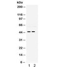 Western blot testing of 1) rat brain and 2) rat lung lysate with PAX2 antibody. Expected/observed molecular weight ~45 kDa.
