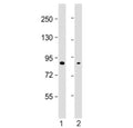 Western blot testing of SMURF2 antibody at 1:2000: Lane 1) human MDA-MB-231 and 2) U-2OS cell lysate. Predicted molecular weight ~86 kDa.