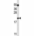 BAX antibody western blot analysis in K562 lysate