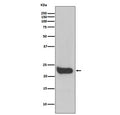 Western blot testing of human HeLa cell lysate with IFNB1 antibody. Predicted molecular weight ~22 kDa.