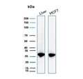 Western blot testing of human liver and MCF7 cell lysate with recombinant HSP27 antibody (clone HSPB1/7038R). Predicted molecular weight: 23-27 kDa.