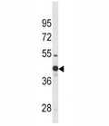 Western blot analysis of WNT4 antibody and mouse bladder tissue lysate.