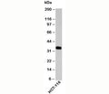 Western blot testing of human samples with EpCAM antibody at 2ug/ml. Expected molecular weight: ~35 kDa (unmodified), 40-43 kDa (glycosylated).