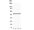 Western blot testing of MBD2 antibody and Lane 1: SGC; 2: HeLa; 3: Jurkat; 4: K562; Predicted/observed molecular weight: ~47kDa.