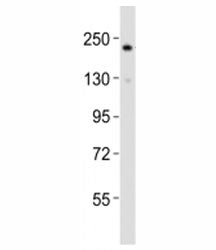 Western blot testing of RICTOR antibody at 1:2000 dilution + HepG2 lysate; Predicted molecular weight ~200 kDa.