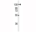 Western blot analysis of FGFR1 antibody and mouse liver tissue lysate. Predicted molecular weight: 75-160 kDa depending on glycosylation level.