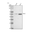 Western blot analysis of IRAK4 using anti-IRAK4 antibody. Lane 1: human Jurkat whole cell lysates, Lane 2: human THP-1 whole cell lysates. After electrophoresis, proteins were transferred to a nitrocellulose membrane at 150 mA for 50-90 min. Blocked the membrane with 5% non-fat milk/TBS for 1.5 hour at RT.