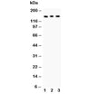 Western blot testing of Insulin Receptor antibody and Lane 1: rat kidney; 2: PANC; 3: HeLa lysate. Expected molecular weight ~156 kDa.