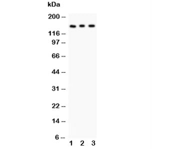 Western blot testing of Insulin Receptor antibody and Lane 1: rat kidney; 2: PANC; 3: HeLa lysate. Expected molecular weight ~156 kDa.