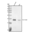 Western blot analysis of Phospho-eIF4EBP1 using anti-Phospho-eIF4EBP1 (Thr70) antibody. Electrophoresis was performed on a 12% SDS-PAGE gel at 80V (Stacking gel) / 120V (Resolving gel) for 2 hours. Lane 1: human SH-SY5Y whole cell lysates, Lane 2: human HEL whole cell lysates. After electrophoresis, proteins were transferred to a nitrocellulose membrane at 150 mA for 50-90 minutes. Blocked the membrane with 5% non-fat milk/TBS for 1.5 hour at RT. The membrane was incubated with rabbit anti-Phospho-eIF4EBP1