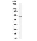 Western blot testing of human heart lysate with TAIP-12 antibody at 0.1ug/ml. Predicted molecular weight: ~59kDa.