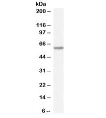 Western blot testing of human heart lysate with TAIP-12 antibody at 0.1ug/ml. Predicted molecular weight: ~59kDa.