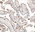 IHC staining of FFPE human placental tissue with 4-Alpha-glucanotransferase antibody. HIER: boil tissue sections in pH8 EDTA for 20 min and allow to cool before testing.