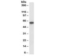 Western blot testing of human kidney lysate with P2rx4 antibody at 1ug/ml. Expected molecular weight: 43-70 kDa depending on glycosylation level.