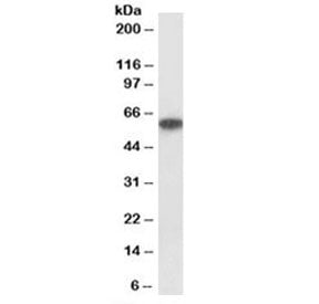 Western blot testing of human kidney lysate with P2rx4 antibody at 1ug/ml. Expected molecular weight: 43-70 kDa depending on glycosylation level.